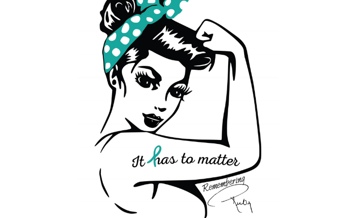 It Has To Matter